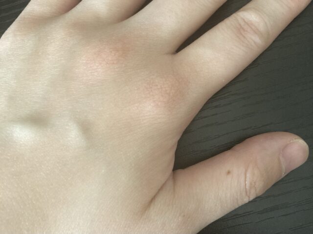 ハロセラピーの方法